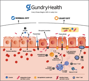 Gundry Health Leaky Gut Diagram