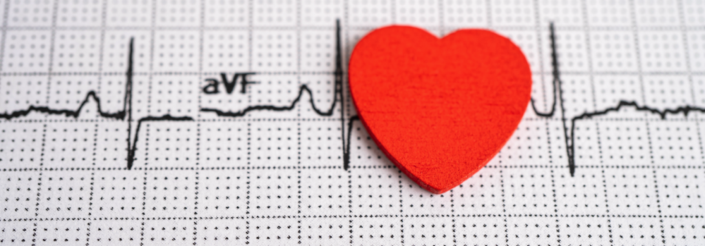 Postural tachycardia syndrome