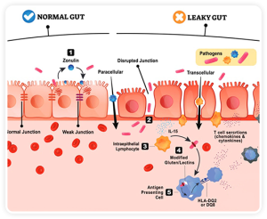 Solve Leaky Gut - A holistic approach to clinical care